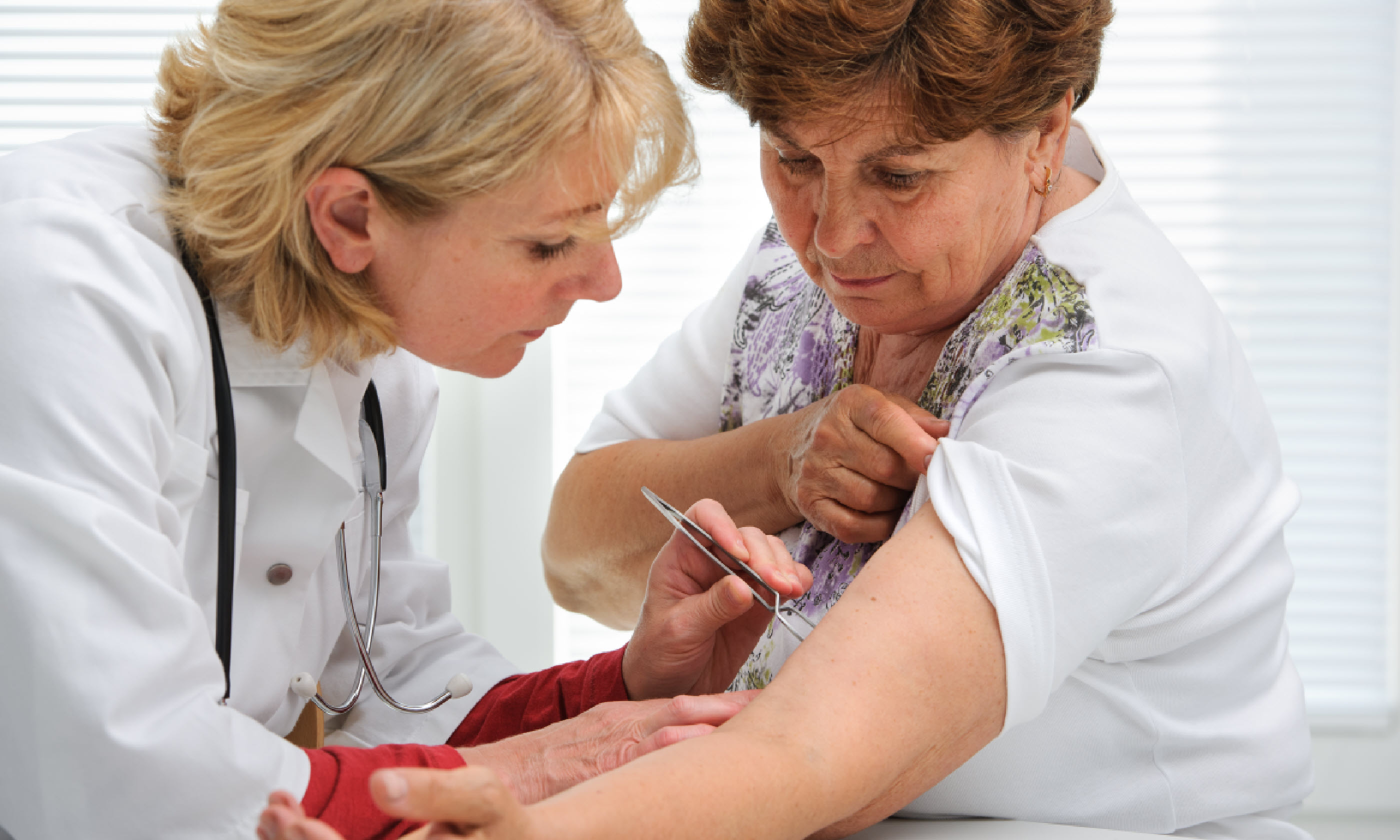 Doctor removing a tick with tweezers from skin of patient (Shutterstock)