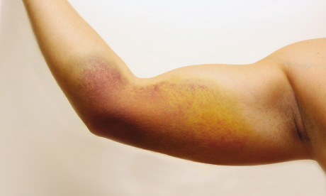 From bumps and bruises to lumps and rashes (iStock)